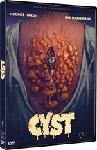 Cyst